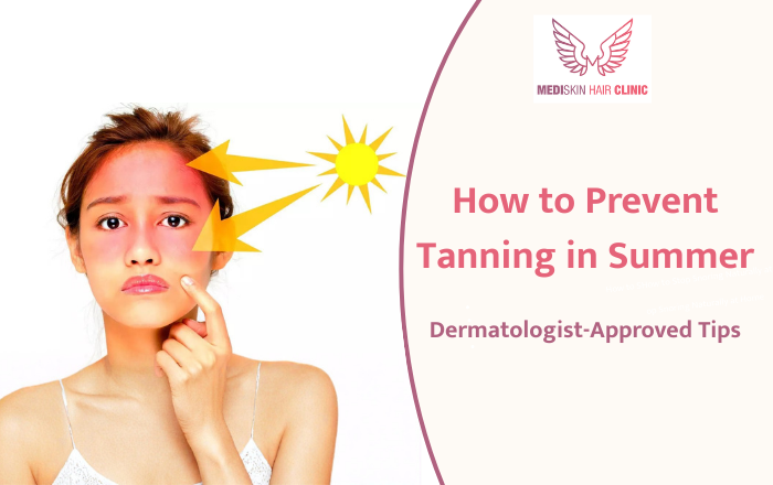 How to Prevent Tanning in Summer: Dermatologist-Approved Tips