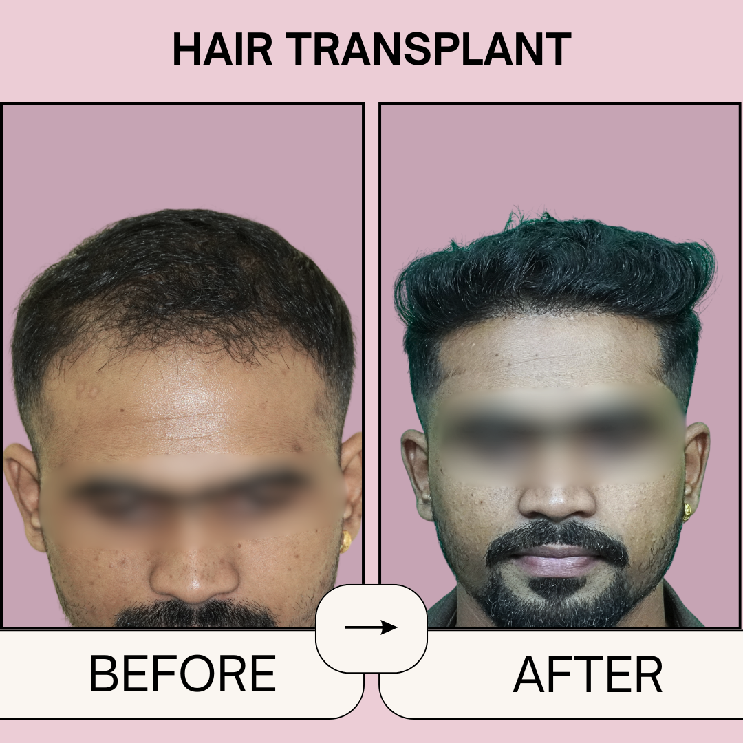 1 (1)