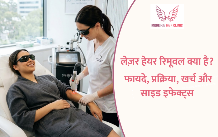 लेज़र हेयर रिमूवल क्या है? फायदे, प्रक्रिया, खर्च और साइड इफेक्ट्स